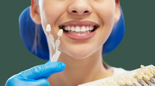 Dental Veneers at Highlandtown Dental Group in Baltimore, Maryland